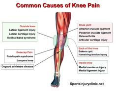 Where is your knee pain and what could be causing it? These are the ...