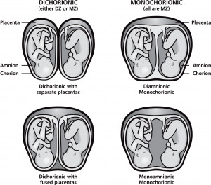 ... easier? Here are the different types of twins by technical name