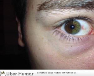 My right eye is split vertically – brown on one side and green on ...