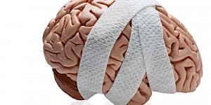 Real Brain Front O-traumatic-brain-injury- ...