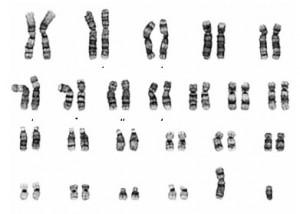 Chromosome Tests (Children with Cleft Lip and Palate)