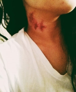 Big Hickies Tumblr