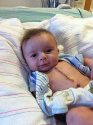 ... month old nephew just had open heart surgery. Chicks dig scars, right