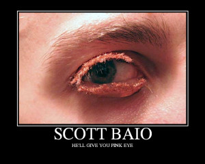Scott Baio gave me pink eye.