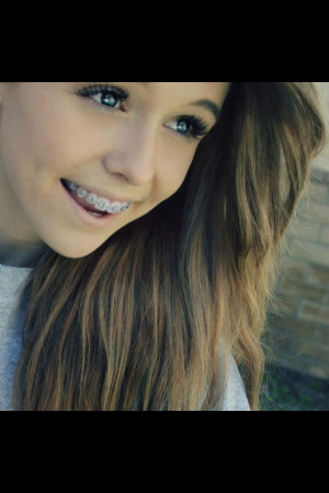 ... Brinley Braces, Beauty, Brinley Clark, Pretty People, Acacia Clark