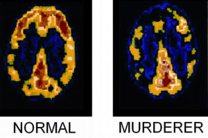 Admissibility of brain scans in criminal trials