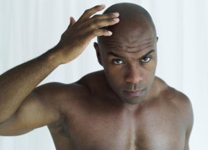 ... Says Balding May Be a Sign of Prostate Cancer in African-American Men