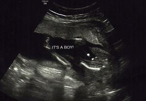 it 39 s a boy ultrasound