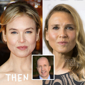 Beverly Hills Plastic surgeon EXCLUSIVELY weighs in on Renee Zellweger ...