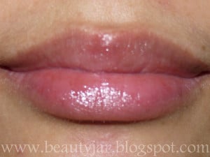 Cold Sore or Pimple On Lip
