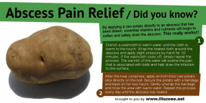 Abscess Pain Relief / Did You Know?