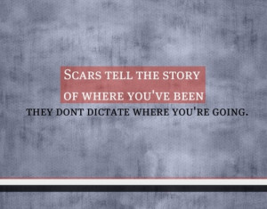 Scars tell the story of where you've been, They don't dictate where ...
