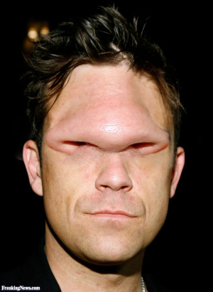 funny robbie williams with a nose for eyes