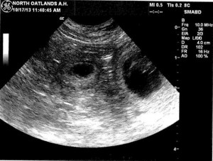 Funny Quotes Contact Us DMCA Notice