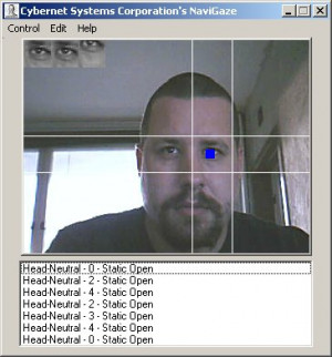 Related To Cartoon Depicting Gout Concerns Aren Stopping The Facial