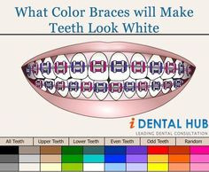... Braces, Choose Colors, Braces Face, Braces Colors, Braces 3