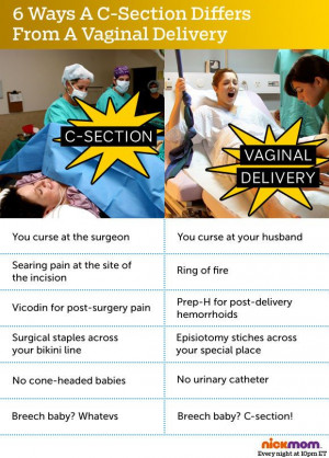Labor Smackdown: C-Section vs. Vaginal Delivery | More LOLs & Funny ...