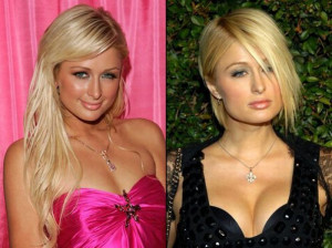 ... 13/celebrities_before_and_after_plastic_surgery_031.jpg_1286983308.jpg