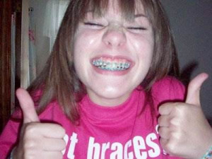 635506643639687993-1727466216_braces-awkward-girl-middle-school ...