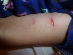 To Write Love On Her Arms my cut