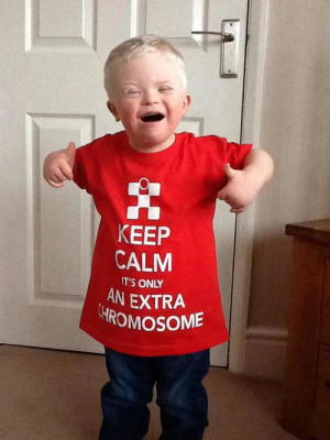 Keep Calm, It’s Only An Extra Chromosome