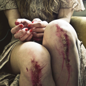girl, hurt, hurts, knees, legs, wounds