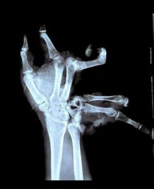 举报 | 个人企业举报 垃圾信息举报