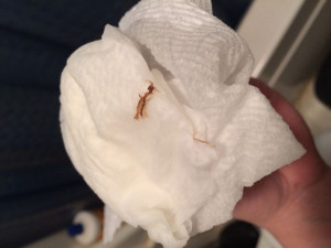 Implantation Bleeding Pictures Does Look Like