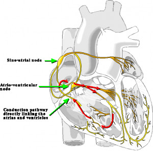 Aberrant Conduction Pathway in Heart