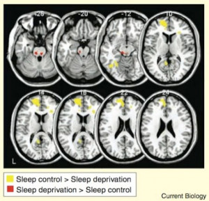 The main finding is that the brain of the sleep-deprived individual is ...