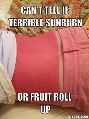 Funny Sun Burn Meme