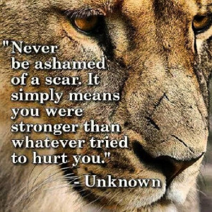 Never be ashamed of your scars...