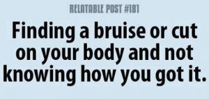 Finding a bruise