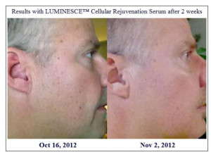 Stem Cell Serum latestest testimonial