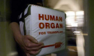 Organ Transplants in Turkey: A Destination for Saving Lives