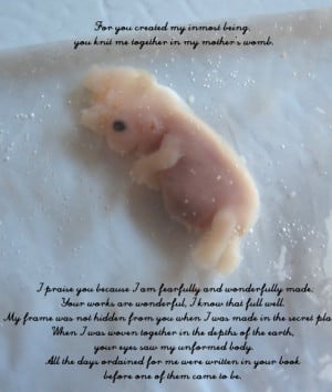 Pictures: Abortion at 6 Weeks