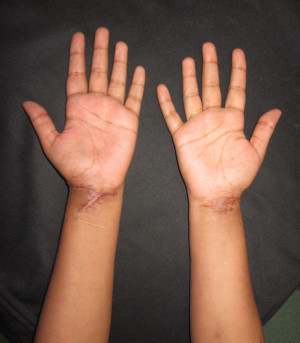 ... -young-female-cut-both-her-wrists-wrist-20cutter-20-285-29.jpg