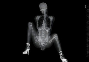 Sexy models under X-ray