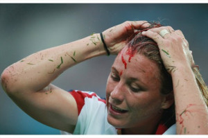 FYI, for anyone wondering, she got the cut stapled shut, and went ...