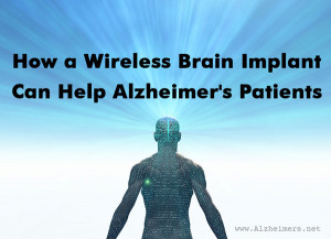 how-a-wireless-brain-implant-can-help-alzheimers-patients.jpg