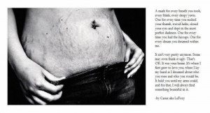 And I love my stretch marks from both of them