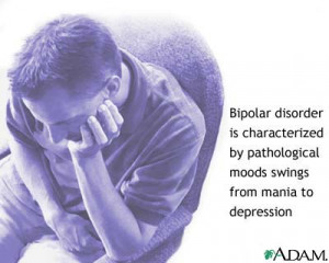 Bipolar disorder is a mood disorder characterized by episodes of mania ...