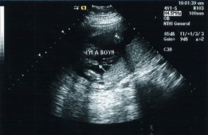 its a boy ultrasound source http imgarcade com 1 its a boy ultrasound