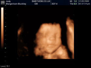 view original image )