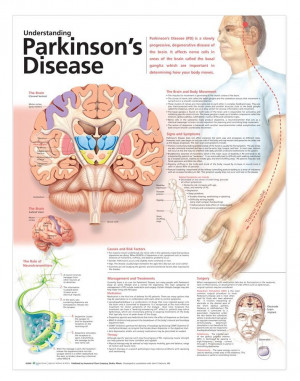 Understanding Parkinsons Disease Anatomical Chart, 2nd Edition