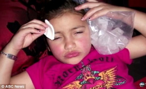 Bruised: Eight-year-old Britney recovers with an ice pack after the ...