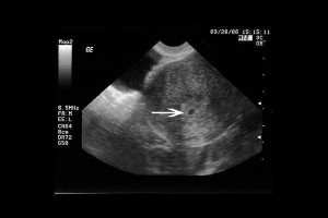 weeks ultrasound