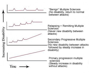 Figure 3. Classifications of Multiple Sclerosis