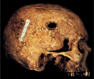 The basics of forensic anthropology