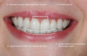 Upper teeth more dominant than lower teeth